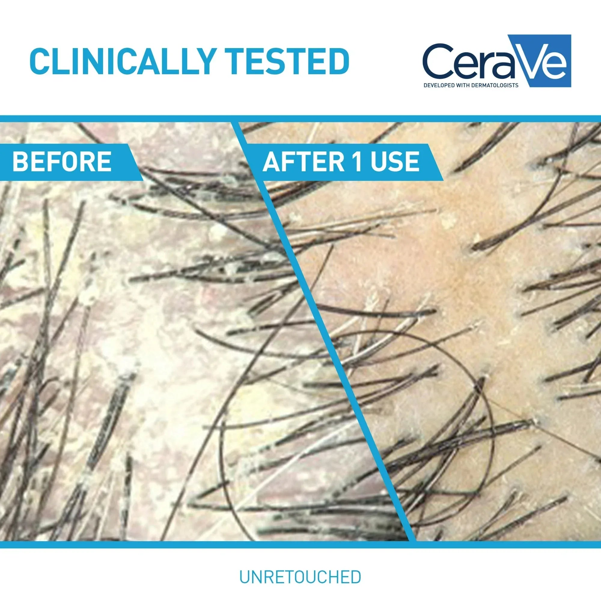 Wholesale Price with free shipping across the USA for CeraVe Hydrating Anti Dandruff Shampoo Sulfate Free & Color Safe Itchy Scalp Treatment - Manji Distributors