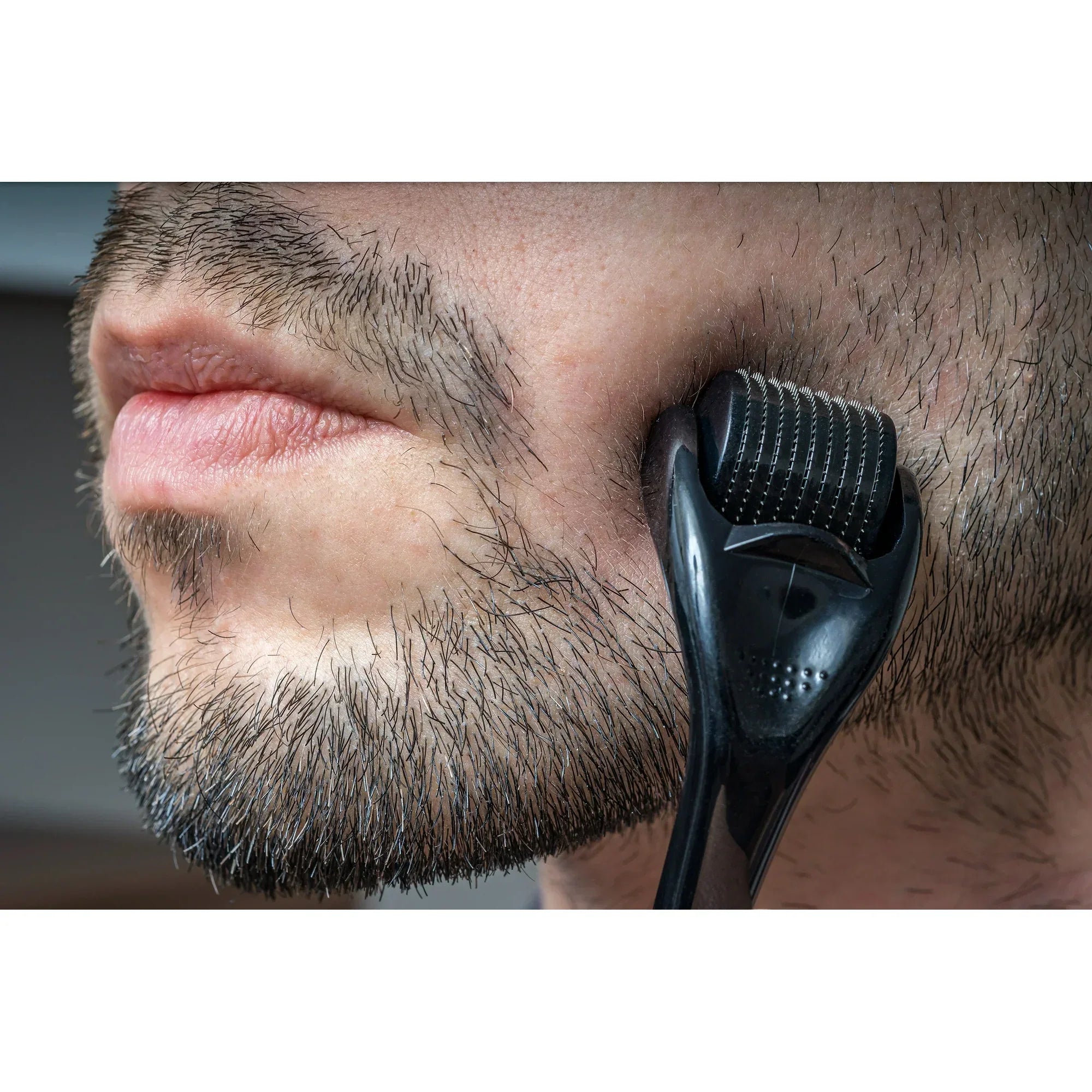 Wholesale Price with free shipping across the USA for Wild Willies Derma Roller for Patchy Beards, 1 Count - Manji Distributors