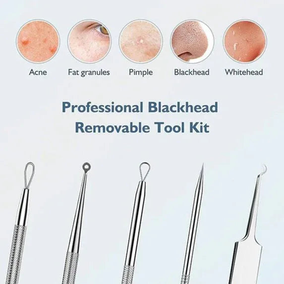 Wholesale Price with free shipping across the USA for Blackhead remover lumps Popper tool kit with diagonal tweezers - Manji Distributors