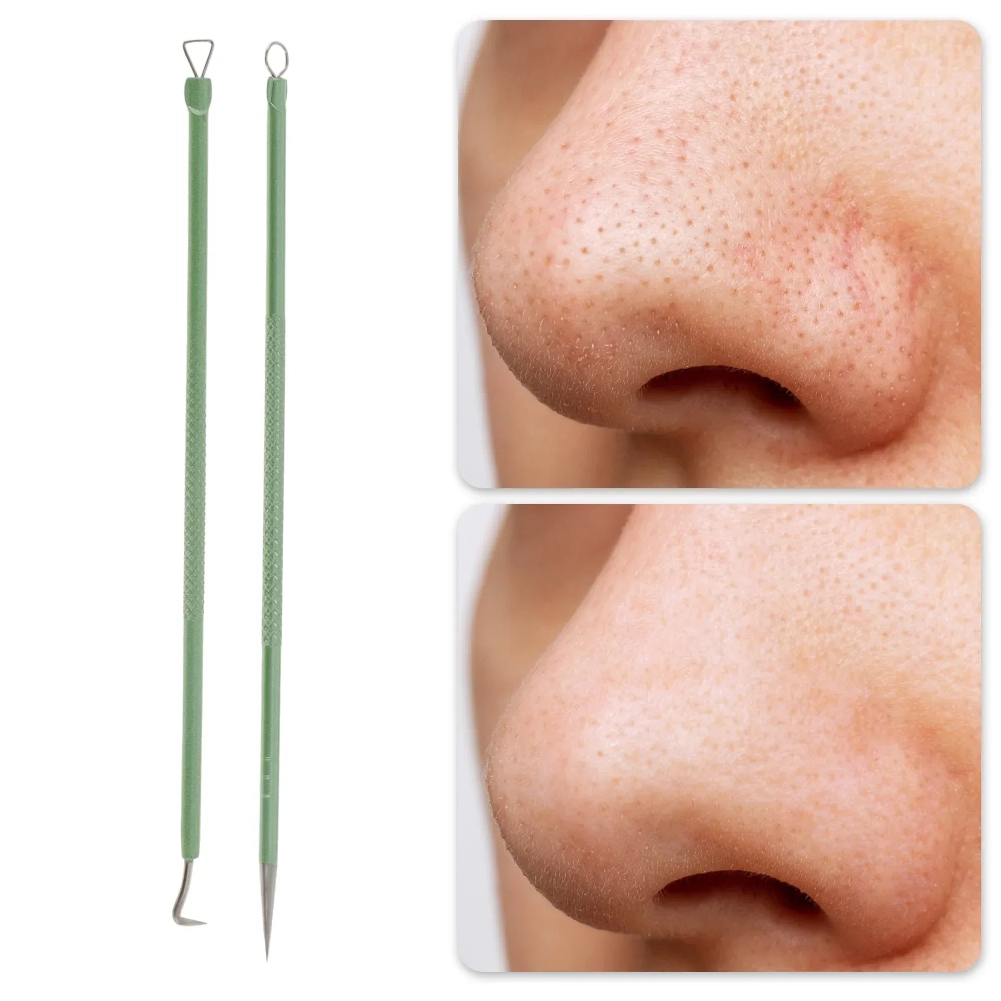 Wholesale Price with free shipping across the USA for Unique Bargains Durable Diagonal Clamp Pimple Extractor Tool Kit Green - Manji Distributors