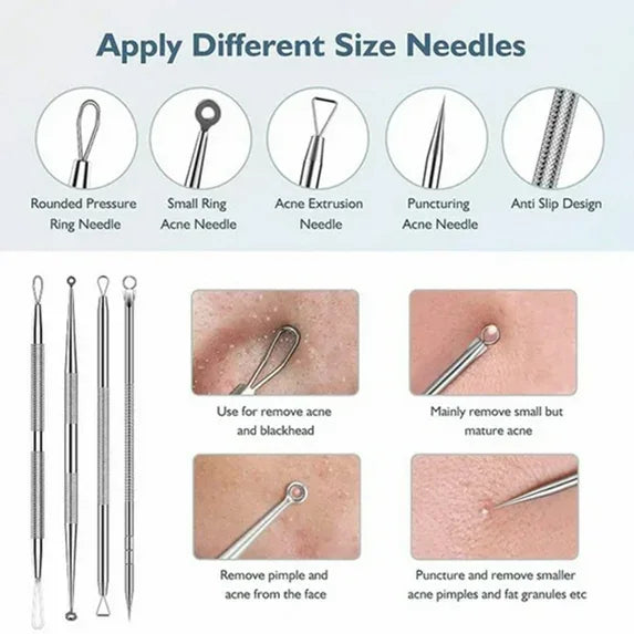 Wholesale Price with free shipping across the USA for Blackhead remover lumps Popper tool kit with diagonal tweezers - Manji Distributors