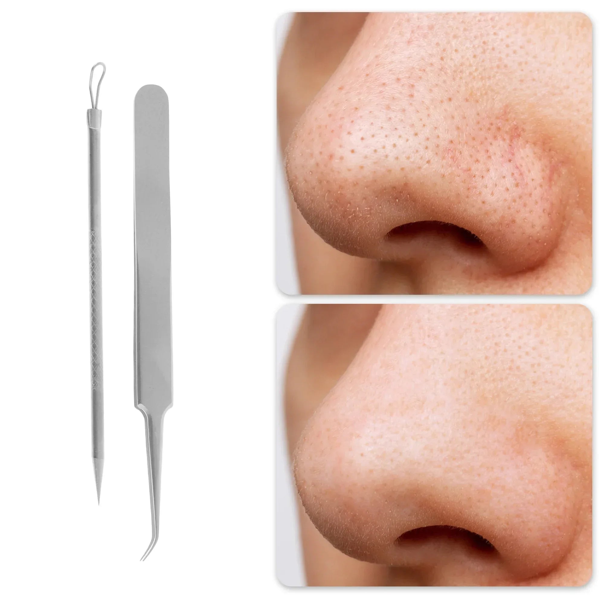 Wholesale Price with free shipping across the USA for Unique Bargains Purification Pimple Extractor Tool Kit Silver Tone - Manji Distributors