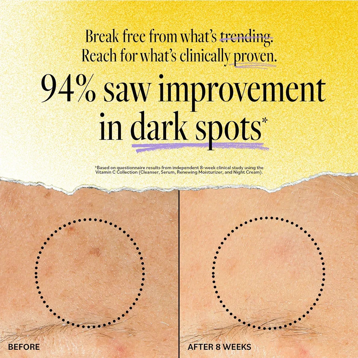 Wholesale Price with free shipping across the USA for Derma E Vitamin C Concentrated Face Serum with Hyaluronic Acid, 2 Fl Oz - Manji Distributors